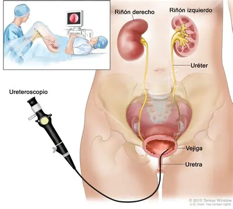 Mantenimiento de la salud de la uretra