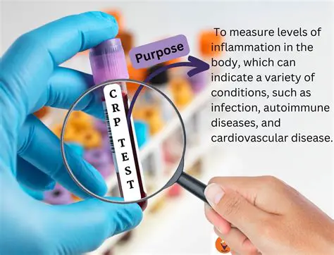 The Importance of NLCR and CRP in SIRS Patients